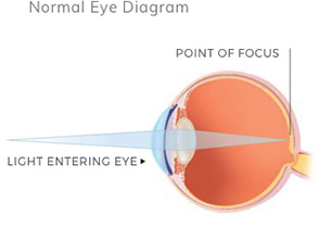 normal-eye