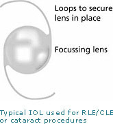 Lens Implant