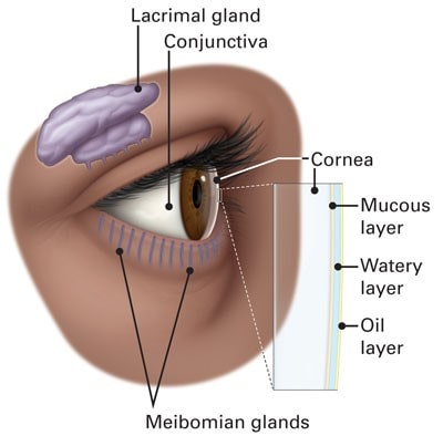 What is Dry Eye?