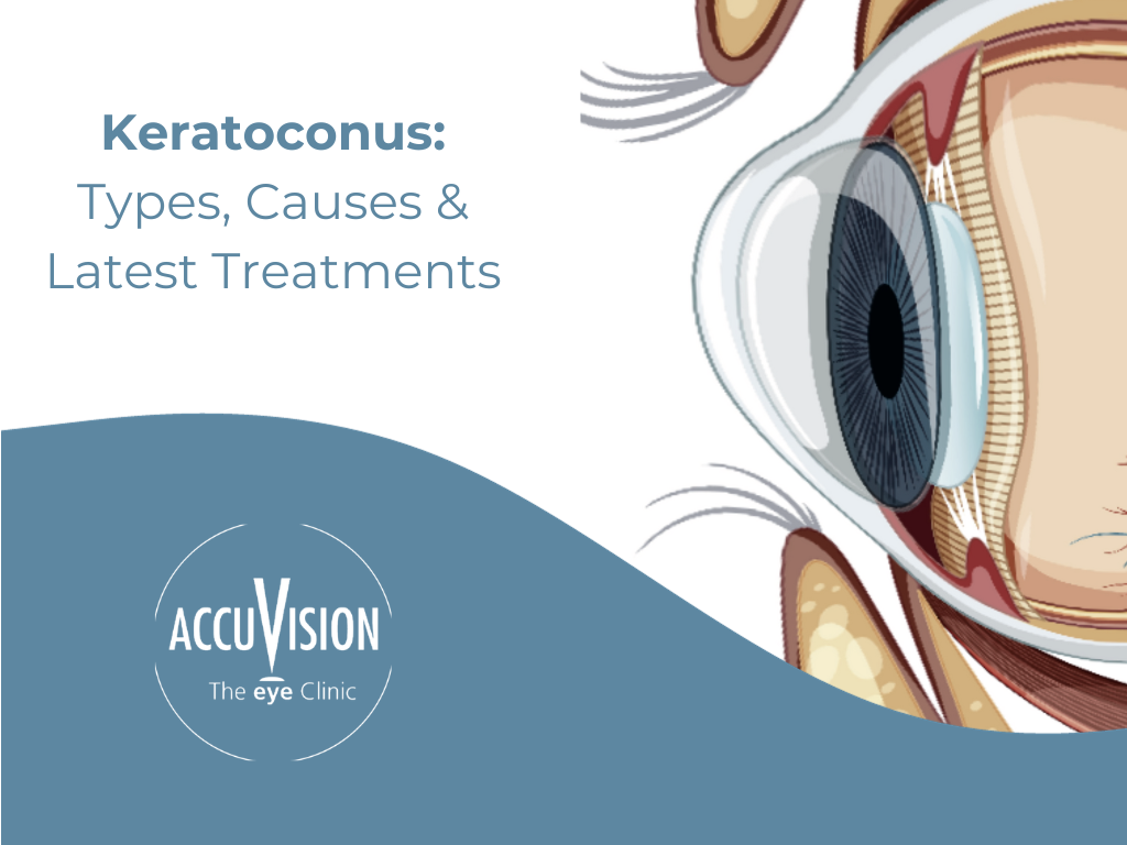 keratoconus: types, causes and latest treatments