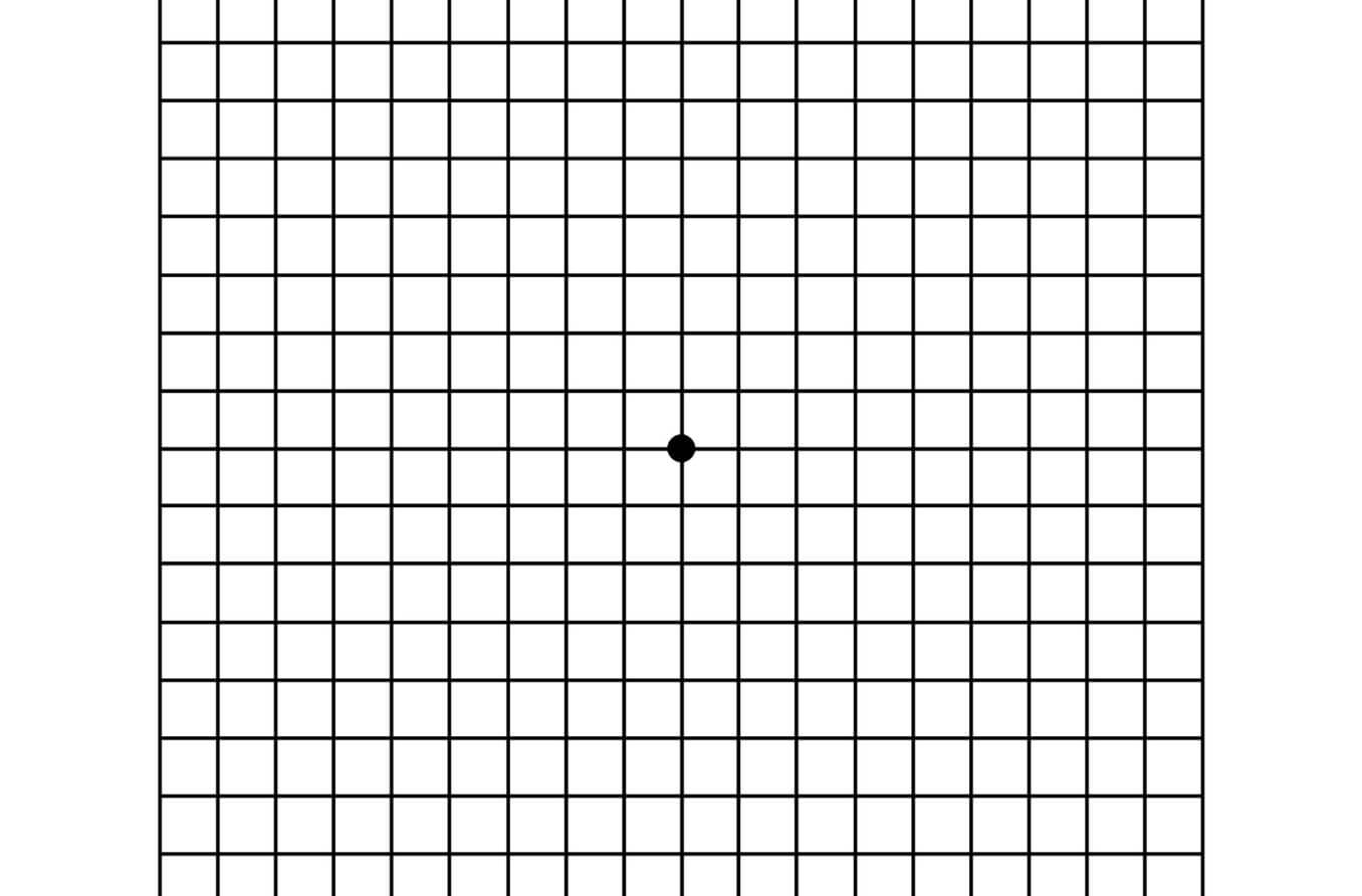 Age-related macular degeneration at-home Amsler Grid test.