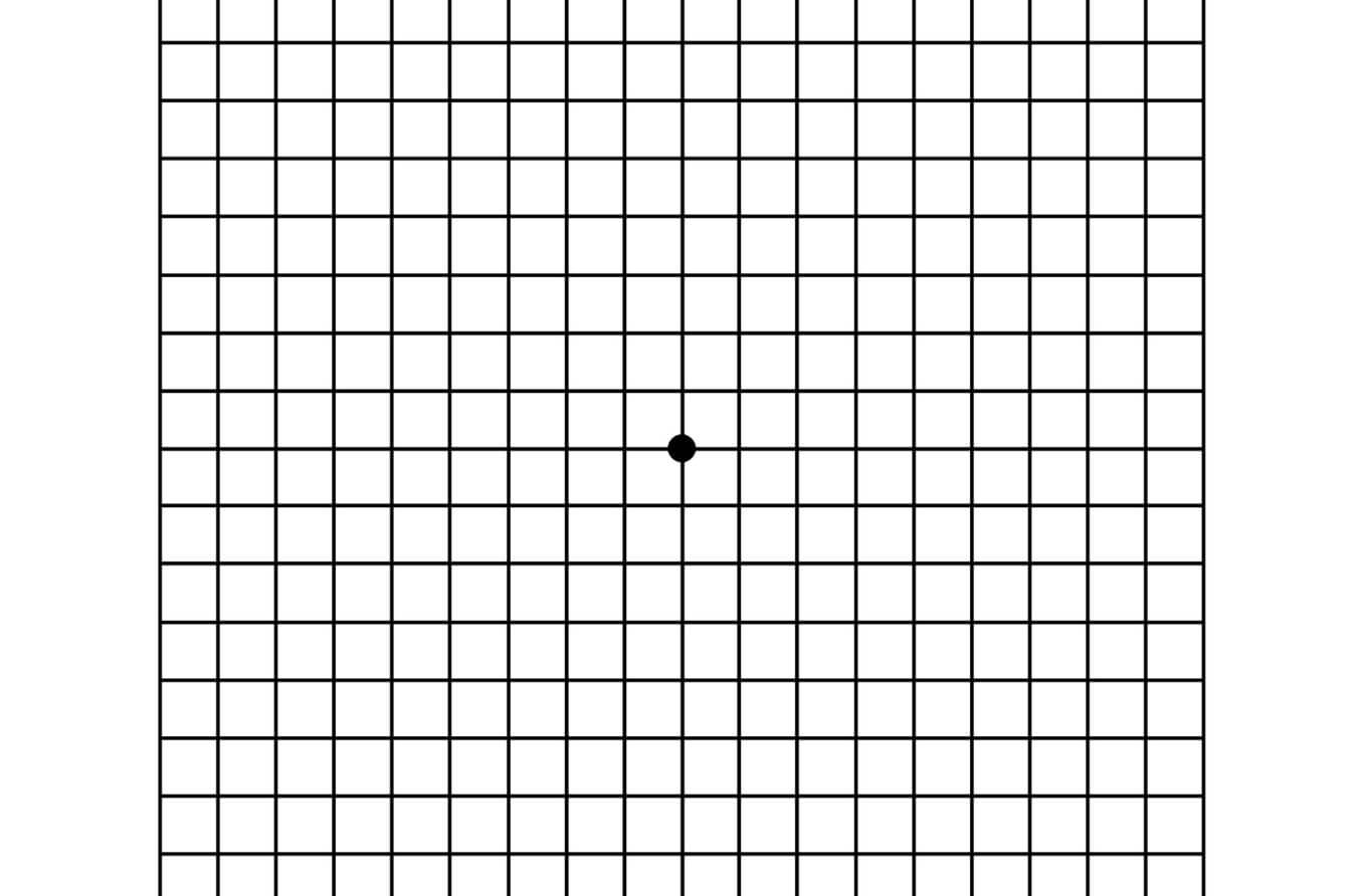 Age-related macular degeneration at-home Amsler Grid test.