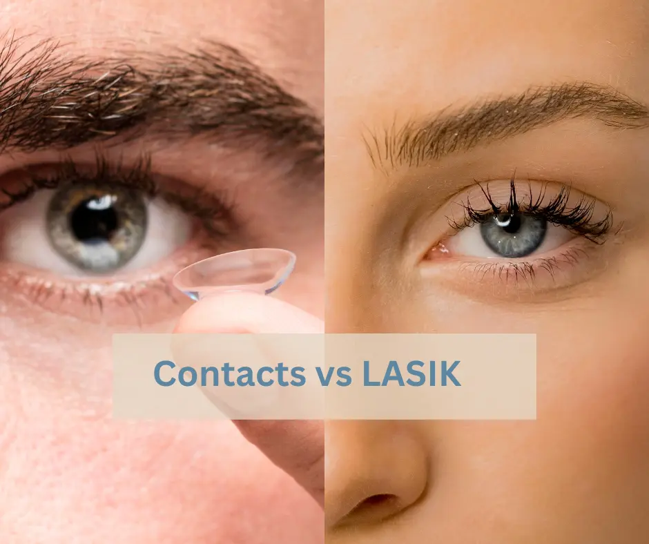 Contact lens vs LASIK 
