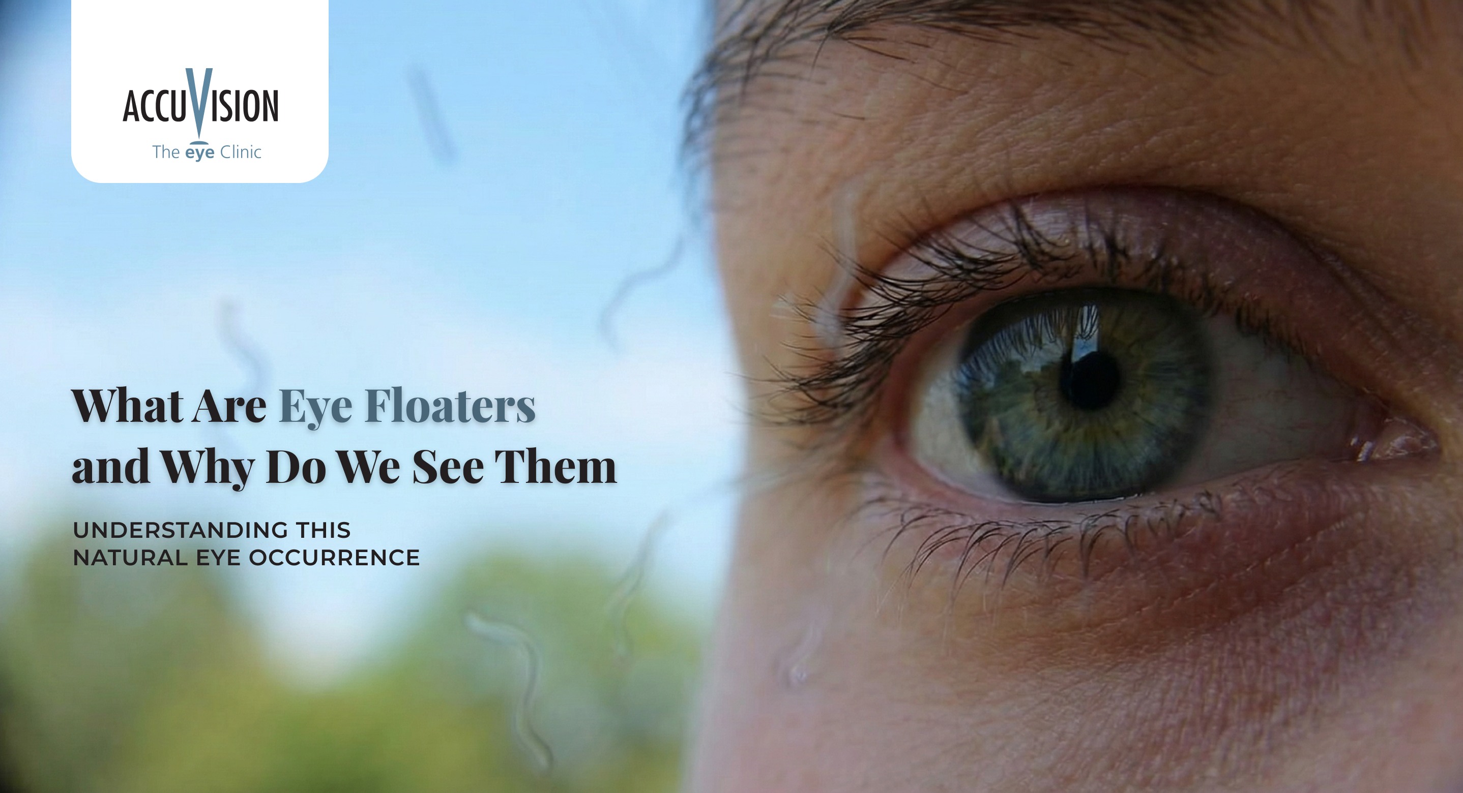 What Are Eye Floaters and Why Do We See Them?