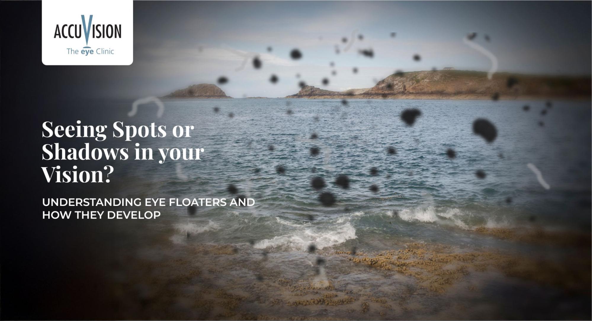 Seeing Spots or Shadows in Your Vision? Understanding Eye Floaters and How They Develop
