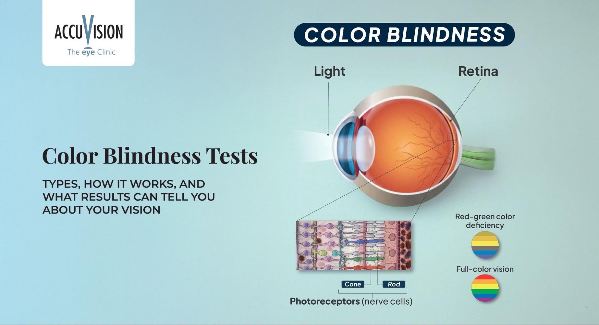 Colour Vision Tests: Types, How They Work, and What Results Can Tell You About Your Vision