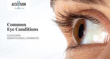Common Eye Conditions Explained: Glaucoma, Keratoconus, Cataracts, and More